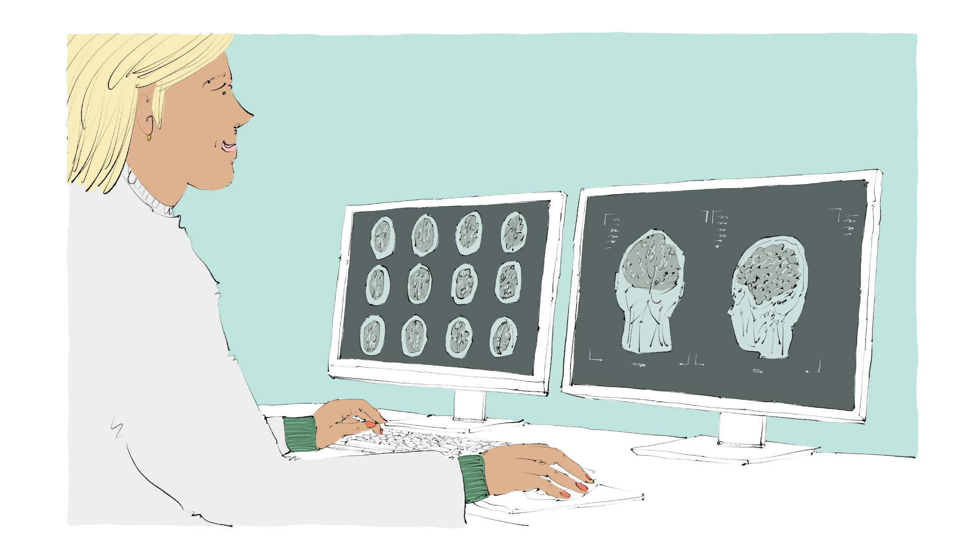 Woman examining brain scans on two computer monitors, illustration